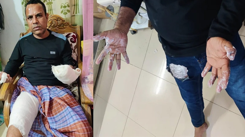 সিম্ফনি মোবাইল বিস্ফোরণে, হাসপাতালে যুবক