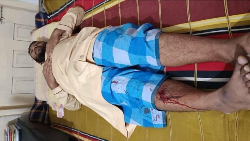 সিলেটে শিবিরের হামলার শিকার জুলাই বিপ্লবের কর্মী রিয়াদ