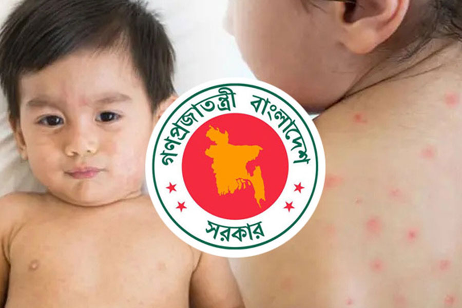 হাম ও উপসর্গে আরও ৬ শিশুর মৃত্যু