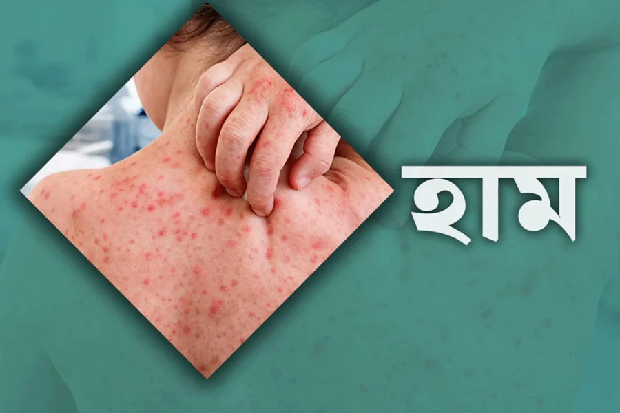 ৬ মাসের কম বয়সী শিশুদের নিয়ে উদ্বেগ বাড়ছে