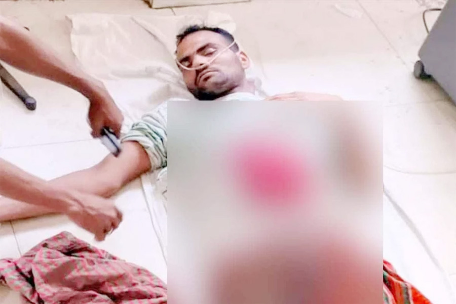 ঝিনাইদহে বিএসএফের গুলিতে বাংলাদেশি যুবক আহত