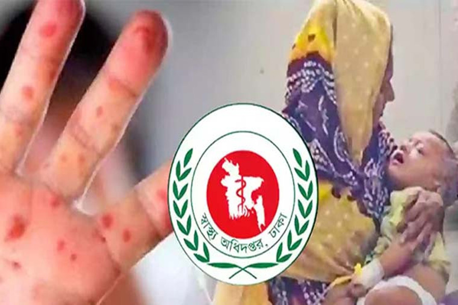 ২৪ ঘণ্টায় হাম ও উপসর্গে আরও ৭ শিশুর মৃত্যু