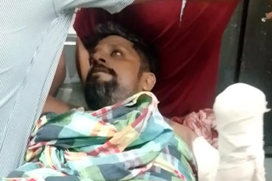 গুরুতর আহত অবস্থায় চুয়াডাঙ্গা থেকে ঢাকার পঙ্গু হাসপাতালে নেওয়া হয় জাহিন শেখকে। ছবি: সংগৃহীত