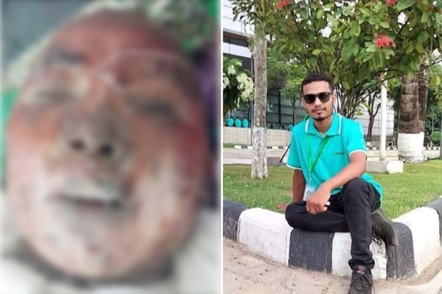 পেট্রোল ঢেলে আগুন দেওয়া গৃহবধূর ৭ দিন পর মৃত্যু