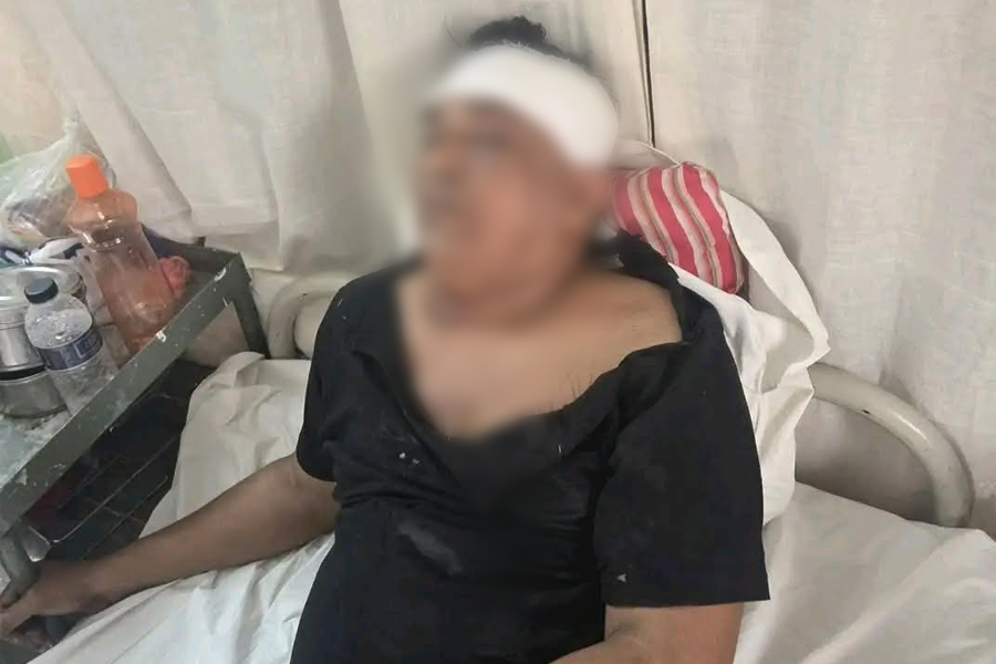 সন্ত্রাসী হামলায় আহত চৌগাছার সাবেক কাউন্সিলর শাহিনুরের মৃত্যু