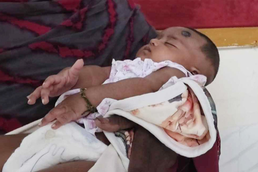 ৩৪ দিনের নবজাতককে ভুলে দেওয়া হলো জলাতঙ্কের টিকা