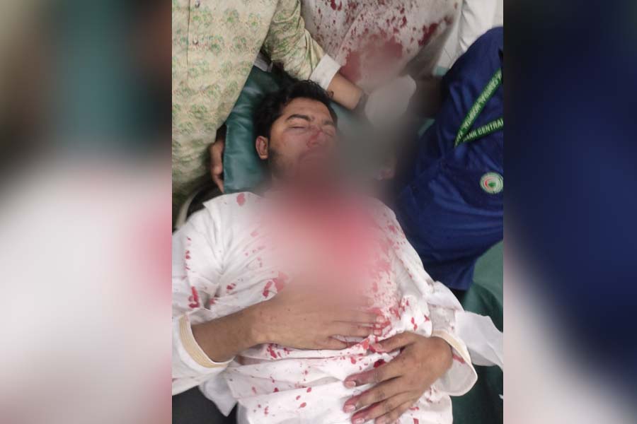 জাপা কার্যালয়ের সামনে সংঘর্ষে গুরুতর আহত নুর