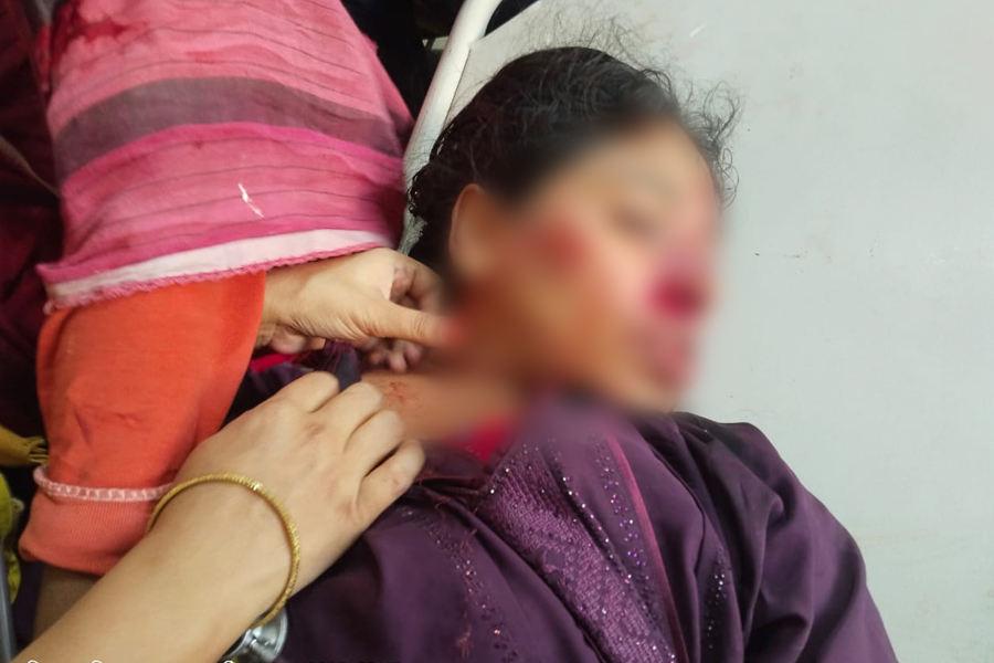 নলছিটিতে ট্রলি গাড়ির ধাক্কায় নারী নিহত