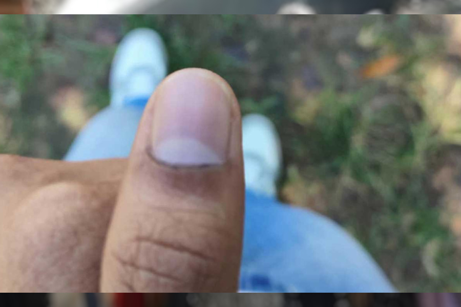 ভোটারের হাতে দেওয়া কালি মুছে যাচ্ছে অভিযোগ ছাত্রদলের