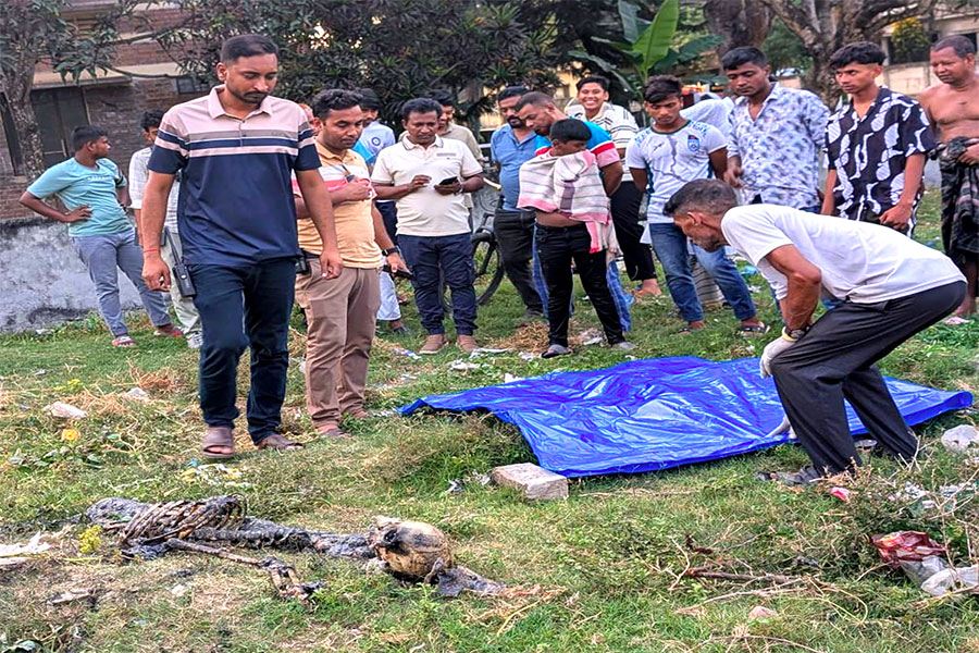 হাসপাতালের ম্যানহোলে মিলল মানব কঙ্কালের অংশ