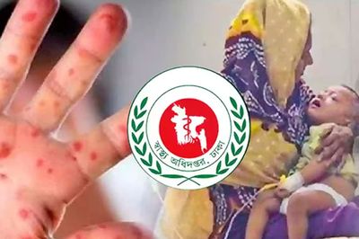 ২৪ ঘণ্টায় হাম ও উপসর্গে আরও ৬ শিশুর মৃত্যু