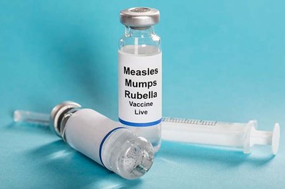 হামের টিকা বঞ্চিত ৫–৮ লাখ শিশু, ভবিষ্যতে বড় প্রাদুর্ভাবের ঝুঁকি