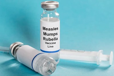 কাদের হামের টিকা নিতে হবে না, জানালেন বিশেষজ্ঞ চিকিৎসক