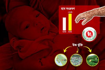 হামের পরিসংখ্যানে শুভঙ্করের ফাঁকি, মৃত্যুঝুঁকিতে হাজারো শিশু