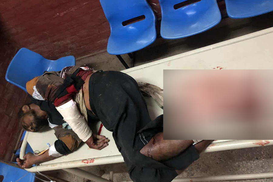 তাড়াশে পরকীয়ার জেরে সংঘর্ষ, প্রেমিক নিহত