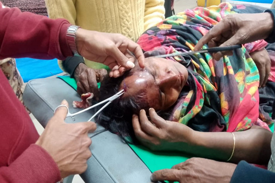 পছন্দের প্রার্থীর পক্ষে কাজ করায় নারীর মাথা ফাটালেন যুবদল নেতা